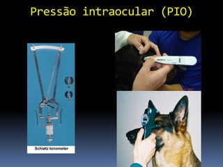 Pressão intraocular (PIO)
 