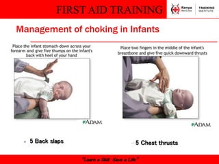 FIRST AID TRAINING
“Learn a Skill Save a Life”
Management of choking in Infants
 5 Chest thrusts
 5 Back slaps
 