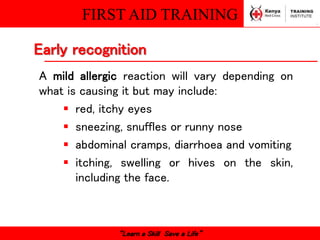 FIRST AID TRAINING
“Learn a Skill Save a Life”
A mild allergic reaction will vary depending on
what is causing it but may include:
 red, itchy eyes
 sneezing, snuffles or runny nose
 abdominal cramps, diarrhoea and vomiting
 itching, swelling or hives on the skin,
including the face.
Early recognition
 