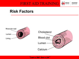 FIRST AID TRAINING
“Learn a Skill Save a Life”
Risk Factors
 