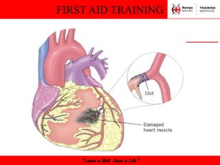 FIRST AID TRAINING
“Learn a Skill Save a Life”
 