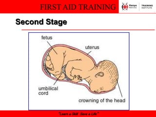 FIRST AID TRAINING
“Learn a Skill Save a Life”
Second Stage
 