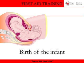 FIRST AID TRAINING
“Learn a Skill Save a Life”
Birth of the infant
 