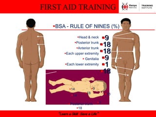 FIRST AID TRAINING
“Learn a Skill Save a Life”
BSA - RULE OF NINES (%)
Head & neck
Posterior trunk
Anterior trunk
Each upper extremity
 Genitalia
Each lower extremity
9
18
18
9
1
18
Posterior trunk
18 18
14
14
9
9
18
 