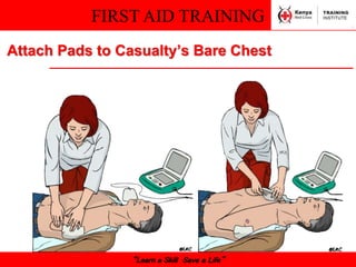 FIRST AID TRAINING
“Learn a Skill Save a Life”
Attach Pads to Casualty’s Bare Chest
 