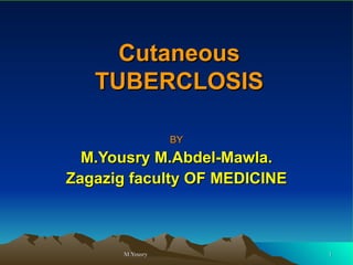 Cutaneous TUBERCLOSIS BY M.Yousry M.Abdel-Mawla. Zagazig faculty OF MEDICINE 