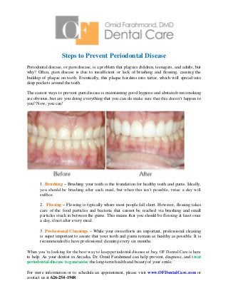 Steps to Prevent Periodontal Disease
Periodontal disease, or gum disease, is a problem that plagues children, teenagers, and adults, but
why? Often, gum disease is due to insufficient or lack of brushing and flossing, causing the
buildup of plaque on teeth. Eventually, this plaque hardens into tartar, which will spread into
deep pockets around the teeth.
The easiest ways to prevent gum disease is maintaining good hygiene and abstain from smoking
are obvious, but are you doing everything that you can do make sure that this doesn’t happen to
you? Now, you can!
1. Brushing – Brushing your teeth is the foundation for healthy teeth and gums. Ideally,
you should be brushing after each meal, but when this isn’t possible, twice a day will
suffice.
2. Flossing – Flossing is typically where most people fall short. However, flossing takes
care of the food particles and bacteria that cannot be reached via brushing and small
particles stuck in between the gums. This means that you should be flossing at least once
a day, if not after every meal.
3. Professional Cleanings – While your own efforts are important, professional cleaning
is super important to assure that your teeth and gums remain as healthy as possible. It is
recommended to have professional cleaning every six months.
When you’re looking for the best way to keep periodontal disease at bay, OF Dental Care is here
to help. As your dentist in Arcadia, Dr. Omid Farahmand can help prevent, diagnose, and treat
periodontal disease to guarantee the long-term health and beauty of your smile.
For more information or to schedule an appointment, please visit www.OFDentalCare.com or
contact us at 626-254-1948.
 
