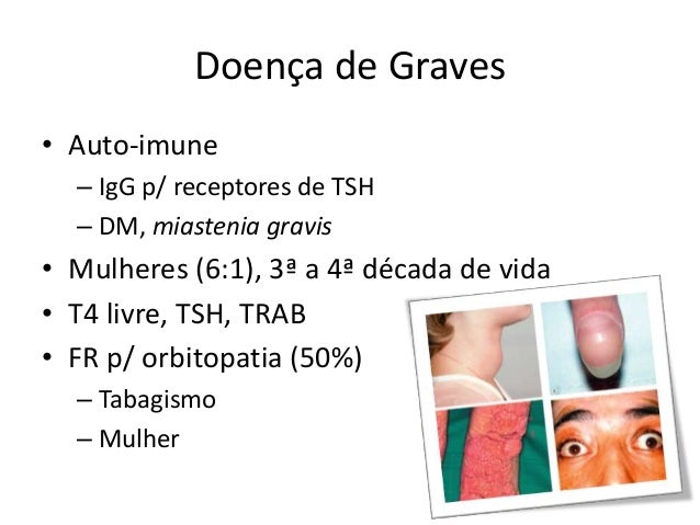 Estrabismo nas miopatias e Doença de graves