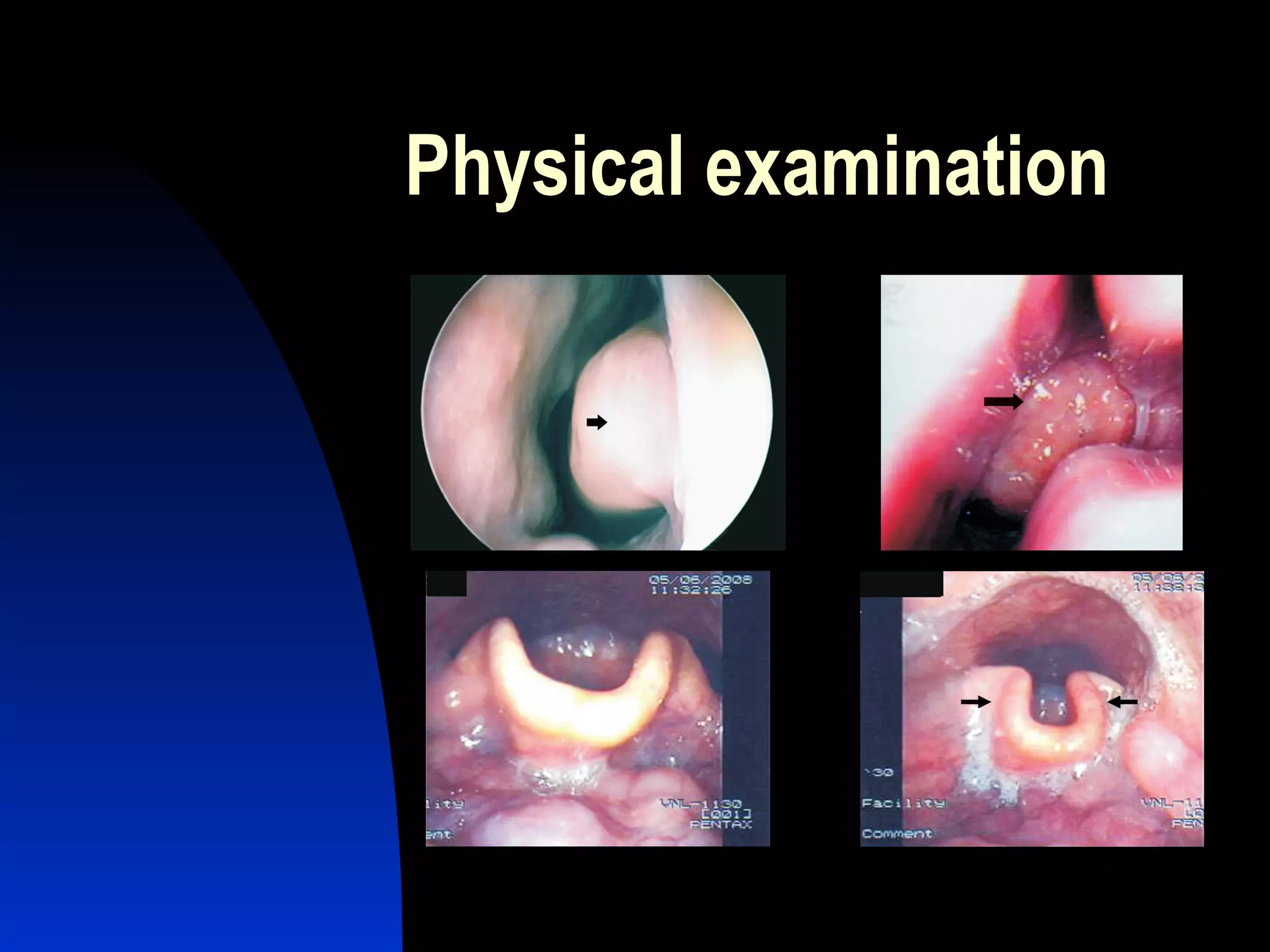Physical examination 