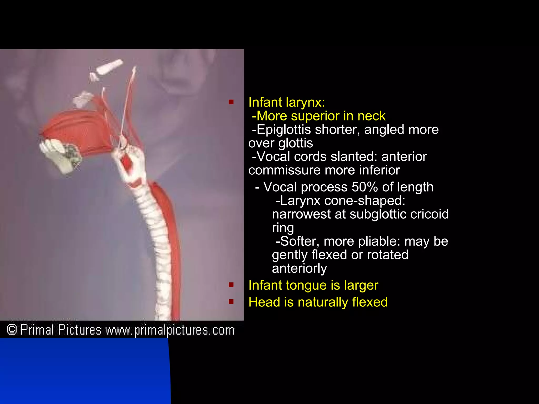 Infant larynx:   -More superior in neck    -Epiglottis shorter, angled more over glottis   -Vocal cords slanted: anterior commissure more inferior - Vocal process 50% of length   -Larynx cone-shaped: narrowest at subglottic cricoid ring   -Softer, more pliable: may be gently flexed or rotated anteriorly  Infant tongue is larger Head is naturally flexed 