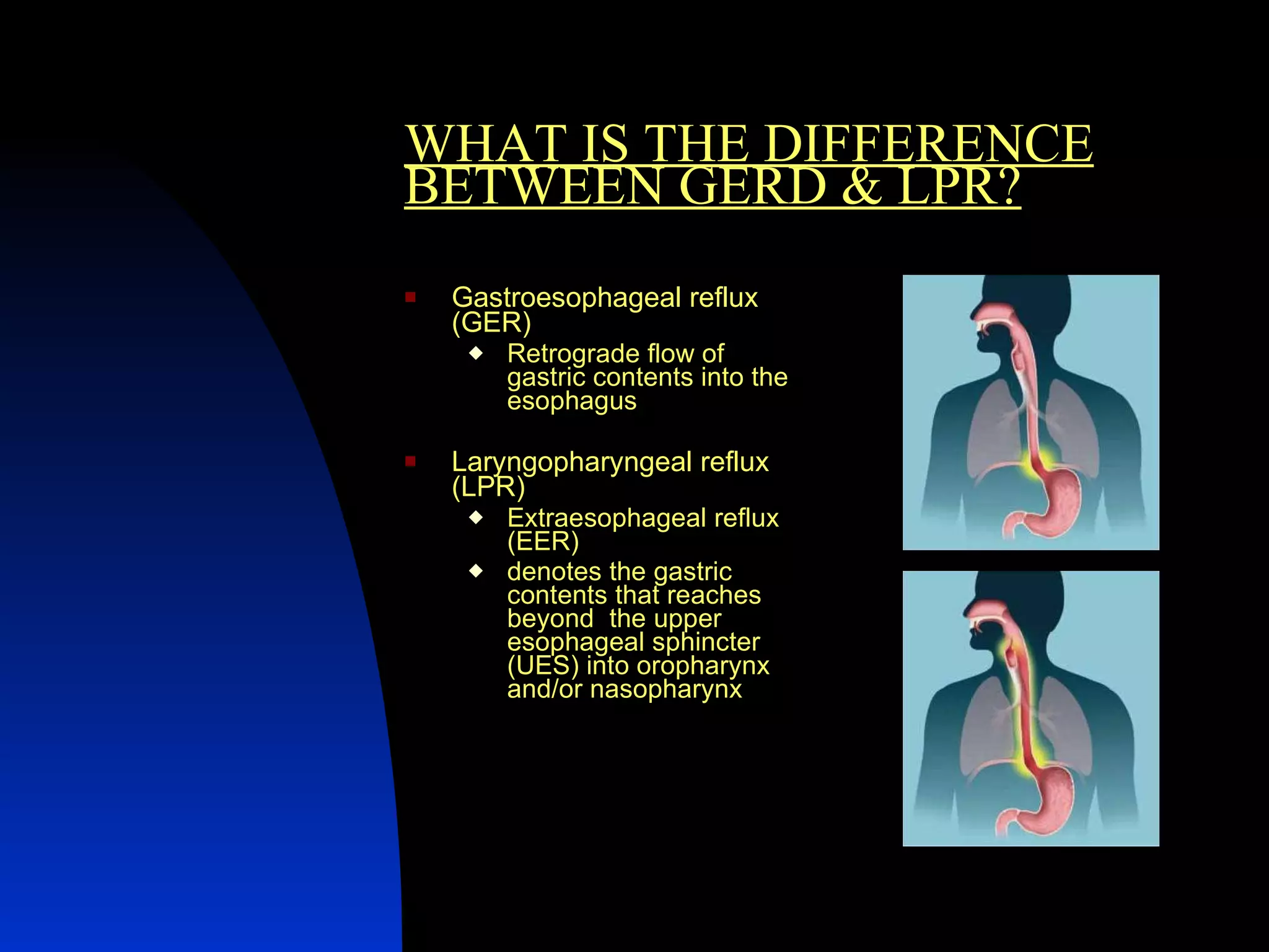 WHAT IS THE DIFFERENCE BETWEEN GERD & LPR? Gastroesophageal reflux   (GER) Retrograde flow of gastric contents into the esophagus Laryngopharyngeal reflux (LPR) Extraesophageal reflux (EER) denotes the gastric contents that reaches beyond  the upper esophageal sphincter (UES) into oropharynx and/or nasopharynx 