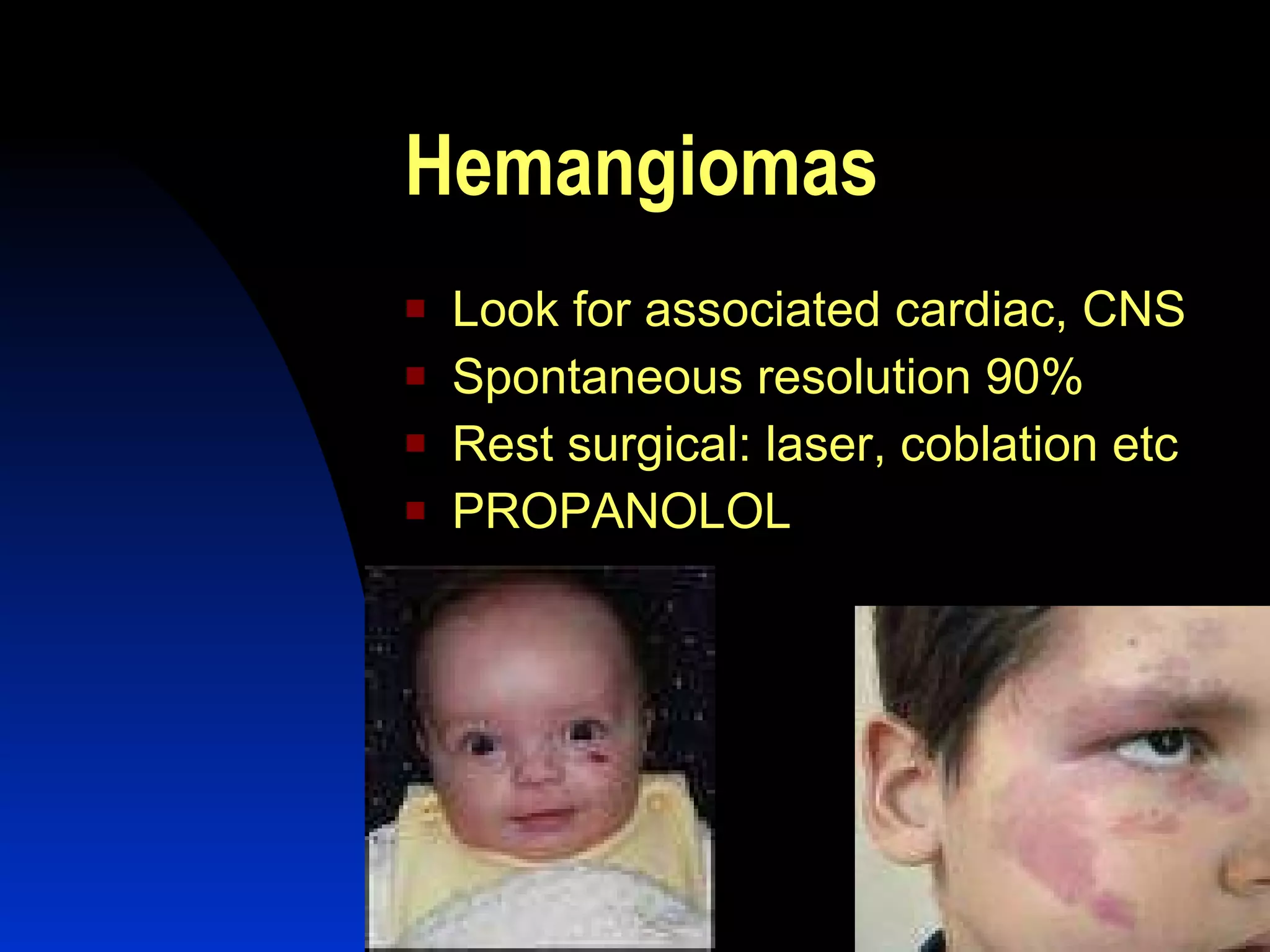 Hemangiomas   Look for associated cardiac, CNS  Spontaneous resolution 90% Rest surgical: laser, coblation etc PROPANOLOL 