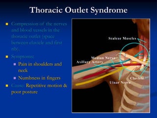 Thoracic Outlet Syndrome
Compression of the nerves
and blood vessels in the
thoracic outlet (space
between clavicle and first
rib).
Symptoms:
    Pain in shoulders and
    neck
    Numbness in fingers
Cause: Repetitive motion &
poor posture
 