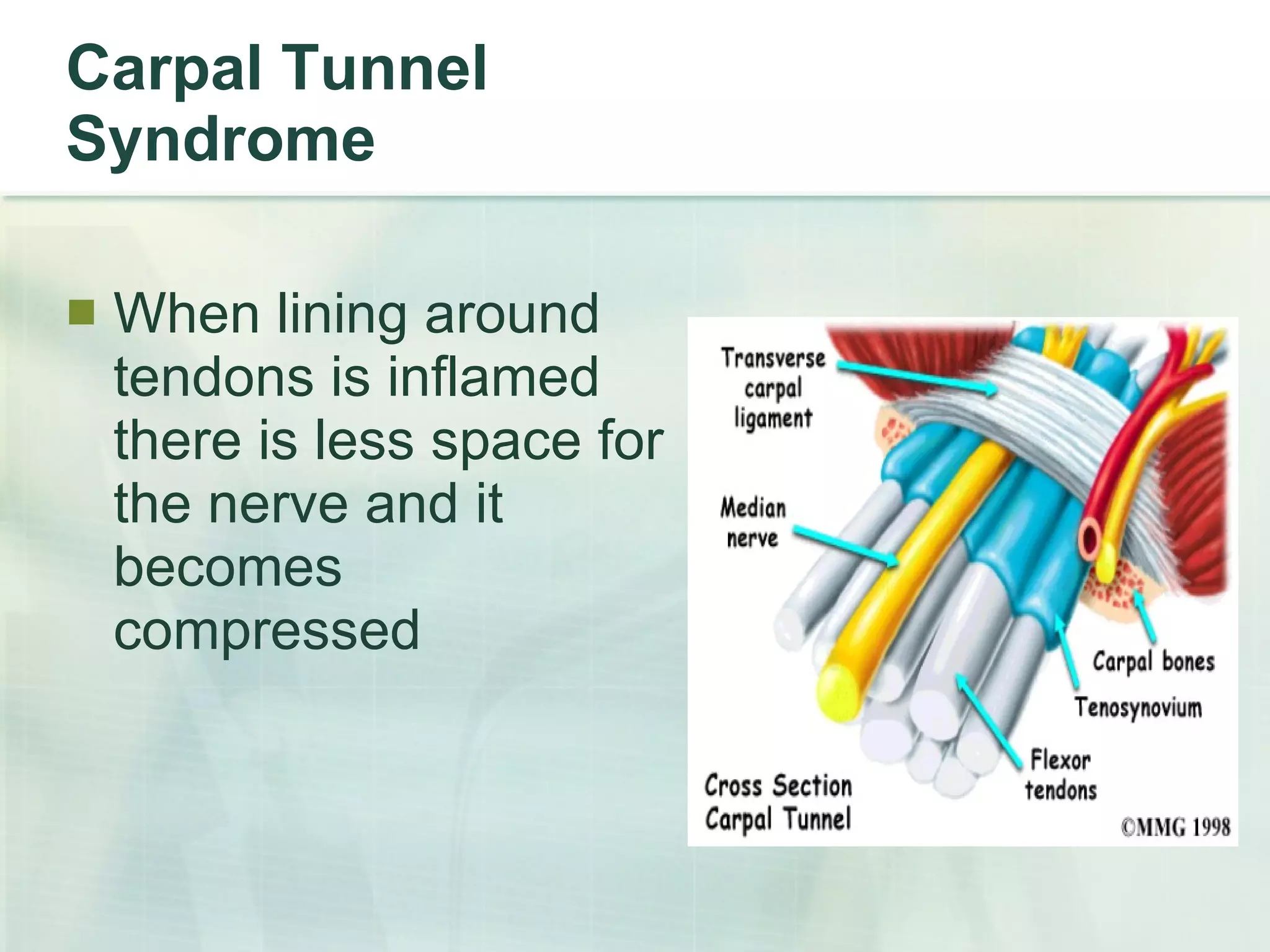 Carpal Tunnel Syndrome When lining around tendons is inflamed there is less space for the nerve and it becomes compressed 