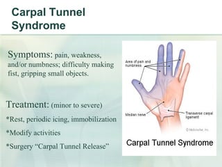 Carpal Tunnel Syndrome Symptoms:  pain, weakness, and/or numbness; difficulty making fist, gripping small objects. Treatment:  (minor to severe) *Rest, periodic icing, immobilization *Modify activities *Surgery “Carpal Tunnel Release” 