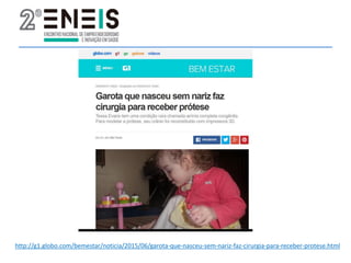 http://g1.globo.com/bemestar/noticia/2015/06/garota-que-nasceu-sem-nariz-faz-cirurgia-para-receber-protese.html
 