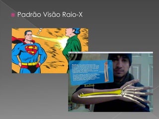 Padrão Visão Raio-X