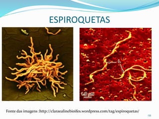 ESPIROQUETAS
135
Fonte das imagens :http://claraealinebioifes.wordpress.com/tag/espiroquetas/
 