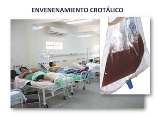 ENVENENAMIENTO	
  CROTÁLICO	
  
 