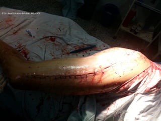 ©	
  Dr.	
  Amel	
  J	
  Bracho-­‐Balcázar,	
  MD.	
  FACP	
  
 