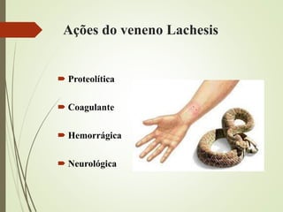 Ações do veneno Lachesis
 Proteolítica
 Coagulante
 Hemorrágica
 Neurológica
 
