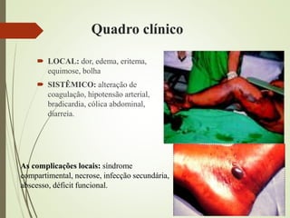 Quadro clínico
 LOCAL: dor, edema, eritema,
equimose, bolha
 SISTÊMICO: alteração de
coagulação, hipotensão arterial,
bradicardia, cólica abdominal,
diarreia.
As complicações locais: síndrome
compartimental, necrose, infecção secundária,
abscesso, déficit funcional.
 