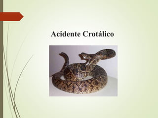Acidente Crotálico
 
