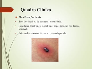 Quadro Clínico
 Manifestações locais
• Sem dor local ou de pequena intensidade.
• Parestesia local ou regional que pode persistir por tempo
variável.
• Edema discreto ou eritema no ponto da picada.
 