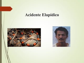 Acidente Elapídico
 