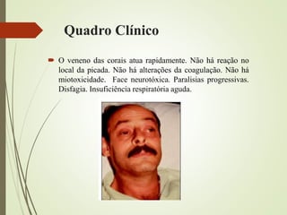 Quadro Clínico
 O veneno das corais atua rapidamente. Não há reação no
local da picada. Não há alterações da coagulação. Não há
miotoxicidade. Face neurotóxica. Paralisias progressivas.
Disfagia. Insuficiência respiratória aguda.
 