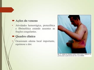  Ações do veneno
• Atividades hemorrágica, proteolítica
e fibrinolítica estando ausentes as
frações coagulantes.
 Quadro clínico
• Ocasionam edema local importante,
equimose e dor.
 