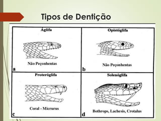 Tipos de Dentição
 