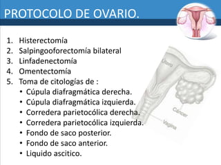 Definición de salpingooforectomía bilateral - Diccionario de