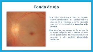 Fondo de ojo
La retina comienza a tener un aspecto
blanco-amarillento o blanco-lechoso,
excepto en la región de la fóvea, en donde
aparece la característica mancha rojo
cereza.
La mancha rojo cereza se forma por la
extrema delgadez de la retina en esta
zona, permitiendo la visualización de la
coroides y del epitelio pigmentado
retiniano
 