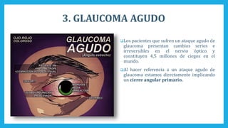 3. GLAUCOMA AGUDO
Los pacientes que sufren un ataque agudo de
glaucoma presentan cambios serios e
irreversibles en el nervio óptico y
constituyen 4,5 millones de ciegos en el
mundo.
Al hacer referencia a un ataque agudo de
glaucoma estamos directamente implicando
un cierre angular primario.
 