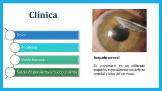 Clínica
Dolor
Fotofobia
Visión borrosa
Secreción purulenta o mucopurulenta
Raspado corneal
Es innecesario en un infiltrado
pequeño, especialmente sin defecto
epitelial y lejos del eje visual
 