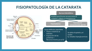 FISIOPATOLOGÍA DE LA CATARATA
Barrera hidrofóbica
Impide que el humor acuoso entre al
cristalino y altere su transparencia.
Traumatismo
Cambios en
concentración del HA
Causa defectos capsulares
• Fibras cristalinas se
hidraten
• Exposición de las
proteínas =
Reconocimiento por el SI
Se daña el epitelio y el
núcleo
Ej. Estados hiperglucemicos
 