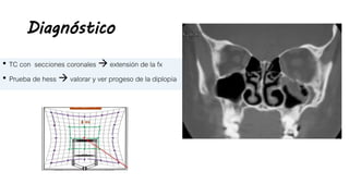 Diagnóstico
• TC con secciones coronales  extensión de la fx
• Prueba de hess  valorar y ver progeso de la diplopía
 