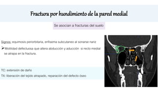 Fractura por hundimiento de la pared medial
Signos: equimosis periorbitaria, enfisema subcutaneo al sonarse nariz
Motilidad defectuosa que altera abducción y aducción si recto medial
se atrapa en la fractura.
Se asocian a fracturas del suelo
TC: extensión de daño
TX: liberación del tejido atrapado, reparación del defecto óseo
 