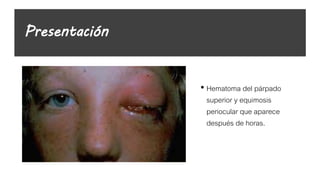Presentación
• Hematoma del párpado
superior y equimosis
periocular que aparece
después de horas.
 