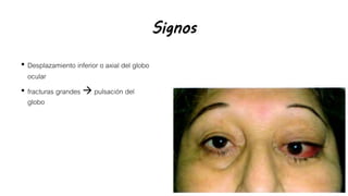 Signos
• Desplazamiento inferior o axial del globo
ocular
• fracturas grandes  pulsación del
globo
 
