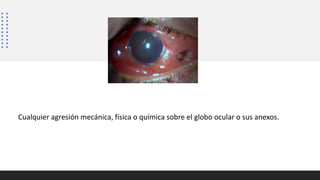 Cualquier agresión mecánica, física o química sobre el globo ocular o sus anexos.
 