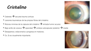 Cristalino
• Catarata  secuela trauma contuso
• Lesiones traumaticas de las propias fibras del cristalino
• Roturas minimas de la cápsula del cristalino  entrada humor acuoso
• Bajo anillo de vossius  opacidad  corteza subcapsular posterior  roseta
• Desaparece, estacionaria o progresa en madurez.
• Cx. Si es visualmente importante.
 