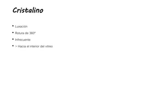 Cristalino
• Luxación
• Rotura de 360º
• Infrecuente
• > Hacia el interior del vitreo
 