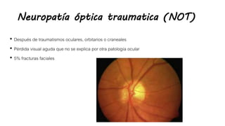 Neuropatía óptica traumatica (NOT)
• Después de traumatismos oculares, orbitarios o craneales
• Pérdida visual aguda que no se explica por otra patología ocular
• 5% fracturas faciales
 