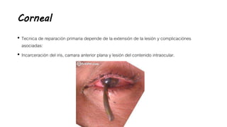Corneal
• Tecnica de reparación primaria depende de la extensión de la lesión y complicaciónes
asociadas:
• Incarceración del iris, camara anterior plana y lesión del contenido intraocular.
 