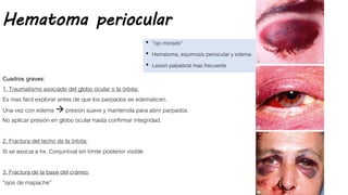 Hematoma periocular
• “ojo morado”
• Hematoma, equimosis periocular y edema
• Lesion palpebral mas frecuente
Cuadros graves:
1. Traumatismo asociado del globo ocular o la órbita:
Es mas facil explorar antes de que los parpados se edematicen.
Una vez con edema  presión suave y mantenida para abrir parpados
No aplicar presión en globo ocular hasta confirmar integridad.
2. Fractura del techo de la òrbita:
Si se asocia a hx. Conjuntival sin límite posterior visible
3. Fractura de la base del cráneo:
“ojos de mapache”
 