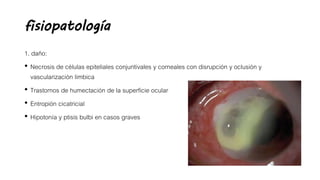 fisiopatología
1. daño:
• Necrosis de células epiteliales conjuntivales y corneales con disrupción y oclusión y
vascularización limbica
• Trastornos de humectación de la superficie ocular
• Entropión cicatricial
• Hipotonía y ptisis bulbi en casos graves
 
