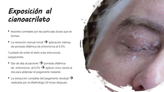 Exposición al
cianoacrilato
• lesiones corneales por las partículas duras que se
forman.
• La remoción manual inicial  aplicación intensa
de pomada oftálmica de eritromicina al 0.5%
*cuidado de evitar el daño a las estructuras
subyacentes.
• Dar de alta al paciente  pomada oftálmica
de eritromicina al 0.5%  aplicar cinco veces al
día para ablandar el pegamento restante.
• La extracción completa del pegamento residual 
realizada por el oftalmólogo 24 horas despues.
 