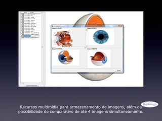 Recursos multimídia para armazenamento de imagens, além da
possibilidade do comparativo de até 4 imagens simultaneamente.
 